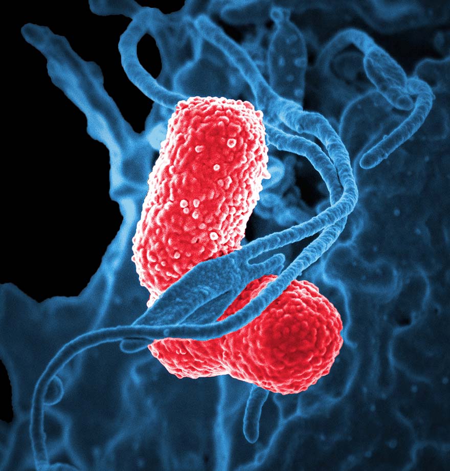 bacteria-细菌 电子显微镜 克雷伯杆菌肺炎 红染色 肺炎 病原 科学 微生物学 流行 生物 高清大图